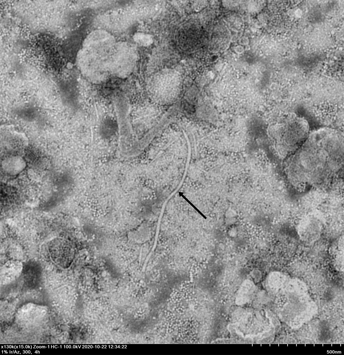 Wirus obecny w liściu monstery adansonii. Widok z mikroskopu elektronowego dzięki uprzejmości Instytutu Ochrony Roślin - PIB w Poznaniu. Zdjęcie wykonała dr Julia Minicka